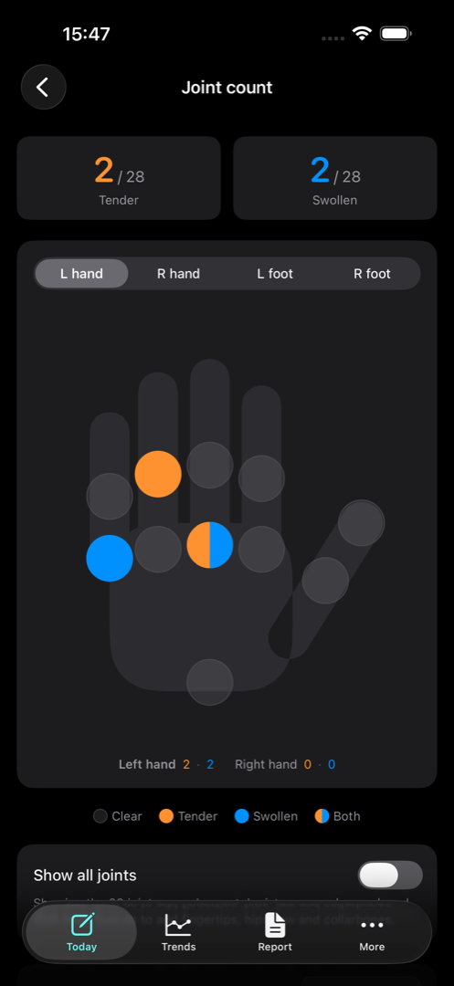 The joint count screen showing a hand diagram with tender and swollen joints marked.